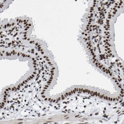 PRCC Antibody, Novus Biologicals:Antibodies:Primary Antibodies